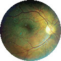 Eye scan from CellScope