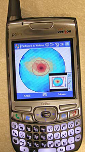 To drive down the cost of medical testing in remote areas, many of Rubinsky’s recent inventions use cellular phones to transmit images and data like this simulated breast tumor, shown in red. For a video of Rubinsky describing the technology, go here. PHOTO COURTESY BORIS RUBINSKY