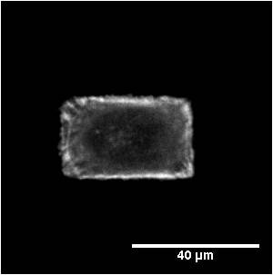 This cancer cell from a human brain is micropatterned to give researchers more control over its area and shape. By first micropatterning the cell and then ablating individual cell components, researchers gain a deeper understanding of the mechanical properties of cell components and how they contribute to physiological processes, such as cancer cell invasion.