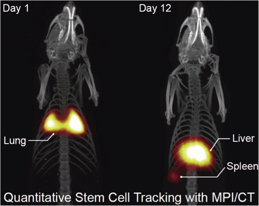 Illustraion of MPI's ability to track stem cells