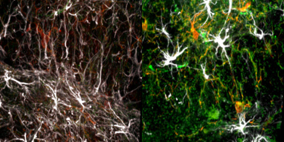 Microglia in young and old brains