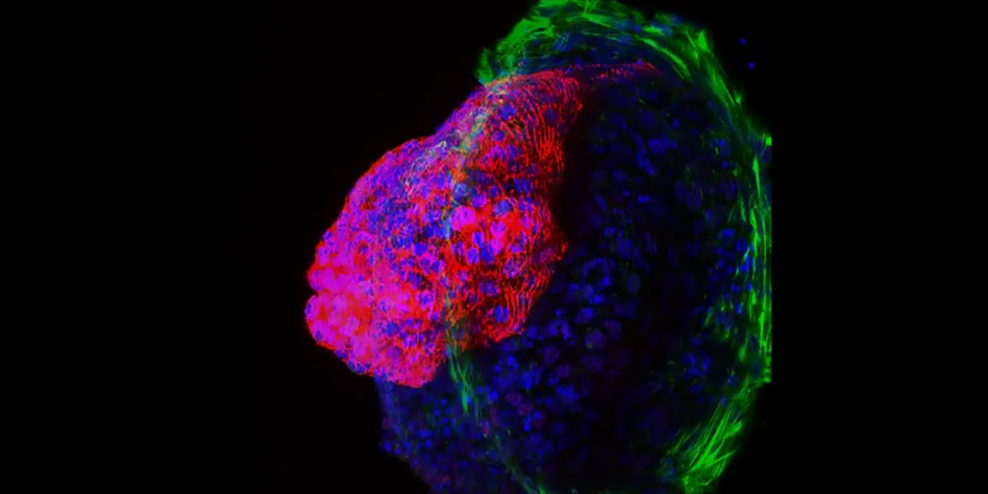 Heart muscle cells (red) and connective tissue (green) grown from stem cells.