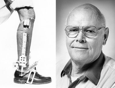 Chuck Radcliffe and a prosthetic ankle
