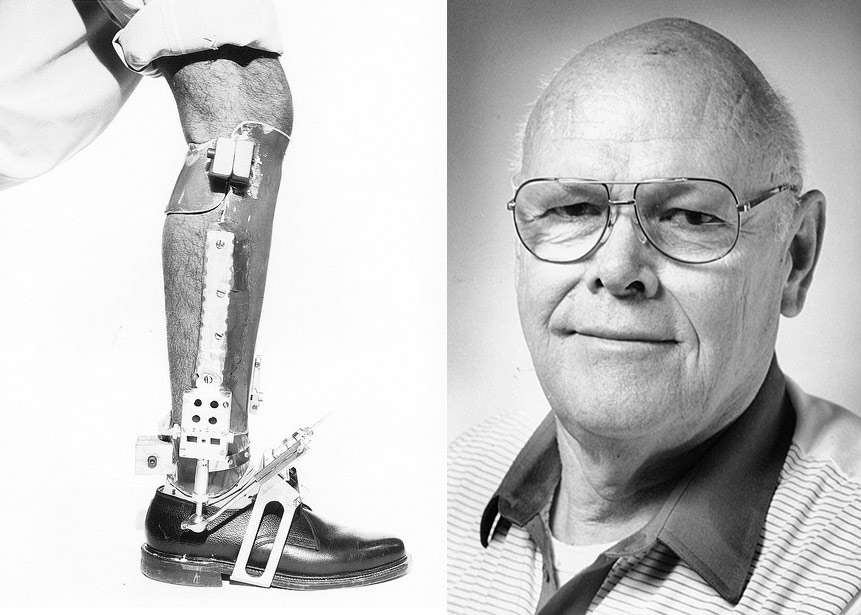 Chuck Radcliffe and a prosthetic leg