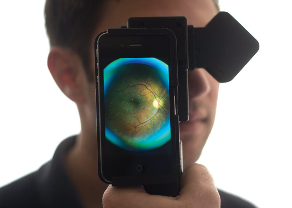Eyeball viewed in Cellscope