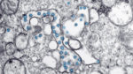 electron microscopic image of the coronavirus