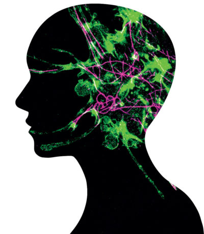 Illustration of cell filaments superimposed over head silhouette