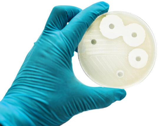 Gloved hand holding a petri dish