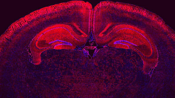 Widespread of transfected cells in the brain by in utero delivery Cre mRNA.