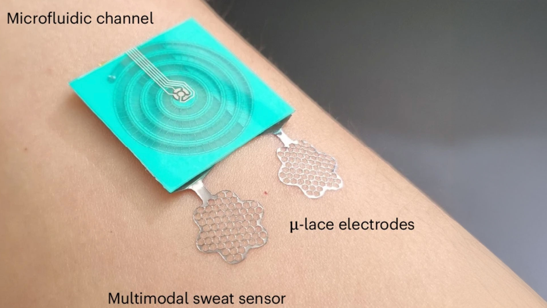 The multimodal sweat sensor, placed on the skin, features a microfluidic channel and breathable μ-lace electrodes.